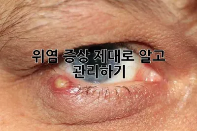 위염 증상, 제대로 알고 관리하기